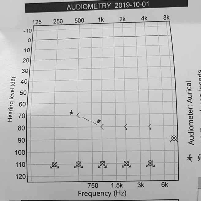 The results of an audiogram test. Symbols are marked across the 110dB marker,